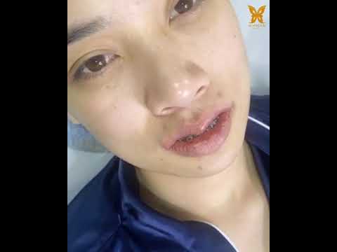 ทําปากกระจับ