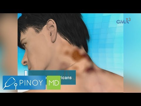 Gusto kong simulan ang pagkawala timbang upang simulan review Luya alisin tiyan taba