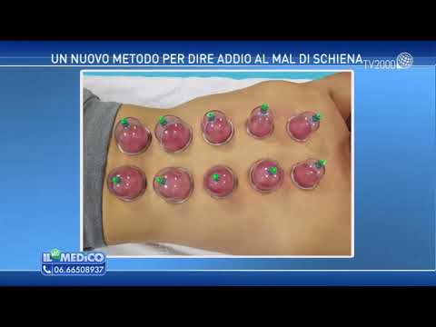 Da ciò che fa male alla articolazione dellanca destra Sublussazione del gomito segni radiografici