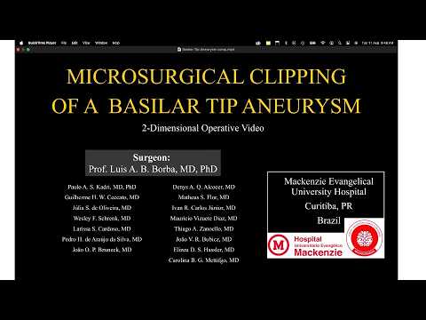 Microsurgical Clipping of a Basilar Tip Aneurysm