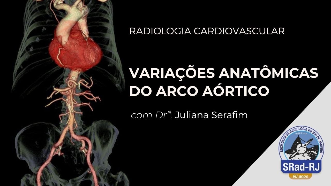 Variações Anatômicas do Arco Aórtico