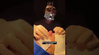 Rinoplastia em homem 🙋‍♂️