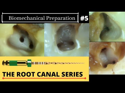 BMP With Rotary and Hand pro-taper file| Dental ji | Basic root canal series | Part 5