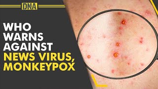 Monkeypox: WHO warns virus spreading in sexual networks. Can the virus lead to another pandemic?