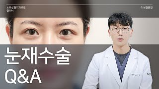[이보형 원장의 Q&A] 눈재수술 특집 l 재수술 시기 l 매몰 재수술 l 회복 기간