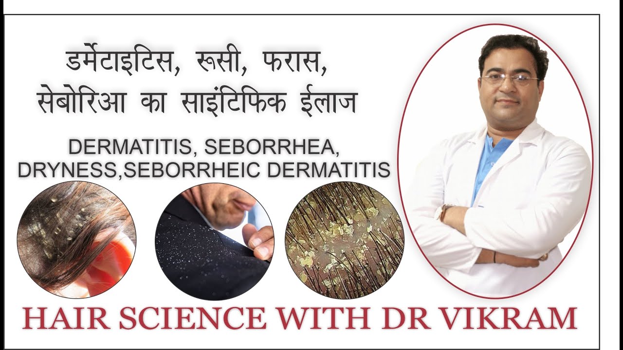 Dandruff, white flakes, itching scalp, seborrhea scalp, shampoo for dandruff treatment.