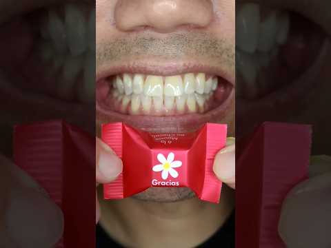 Gracias | Ritter SPORT Cubes Thank You Chocolate #Doctor Tristan Peh #ASMR #shorts 🤤🌸🍫🍬 #short