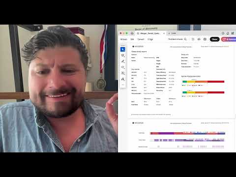 Dr. Gartenberg Evaluating Sleep Apnea with Wesper ... - YouTube