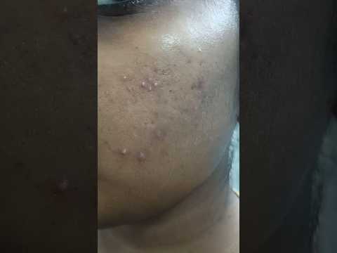 snail mucin essence 😭😭 my money waste 💰🥺 #shorts