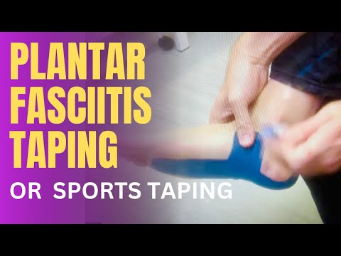 Plantar Fasciitis Sports or Kinesiology Taping
