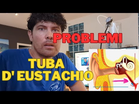 Come ho risolto i problemi di COMPENSAZIONE