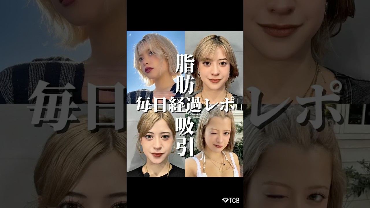 【脂肪吸引】 脂肪吸引レポ #shorts