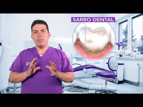🧐 ¿Sabes qué es el SARRO DENTAL?