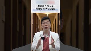 패인 흉터 치료와 큐어젯의 역할