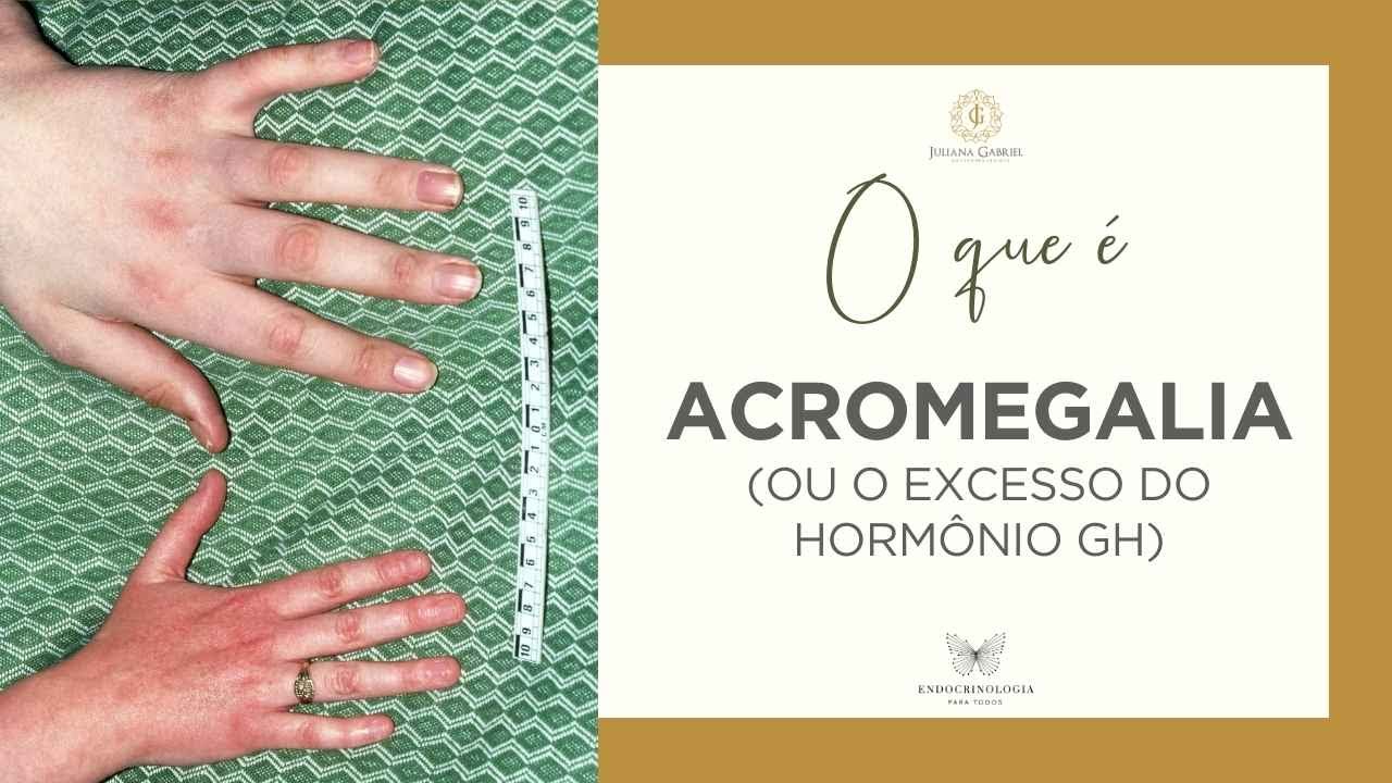 Excesso de GH: quais as causas e sintomas? | Acromegalia & Gigantismo