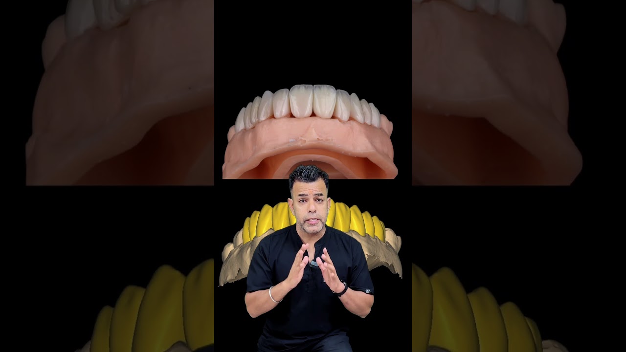 Top Delhi Dentist Reveals BEST Bruxism Treatment Techniques