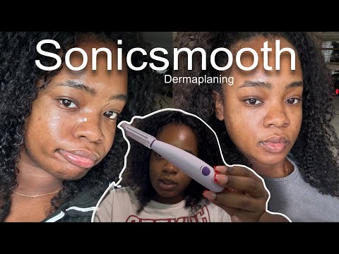 Sonicsmooth Dermaplaning Tool Review ✨ | Instant Glow & Smooth Skin! | Michael Todd Beauty