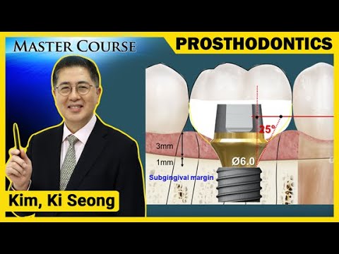 [Master Course Season2 -PROSTHODONTICS] Selecting Abutments for the Posterior Region