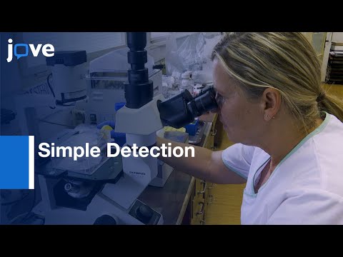 Simple Detection: Primary Cilia By Immunofluorescence l Protocol Preview