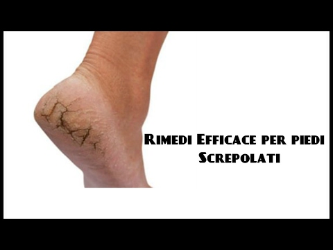 Come trattare cintura lombalgia Mal di schiena nel terzo trimestre di gravidanza