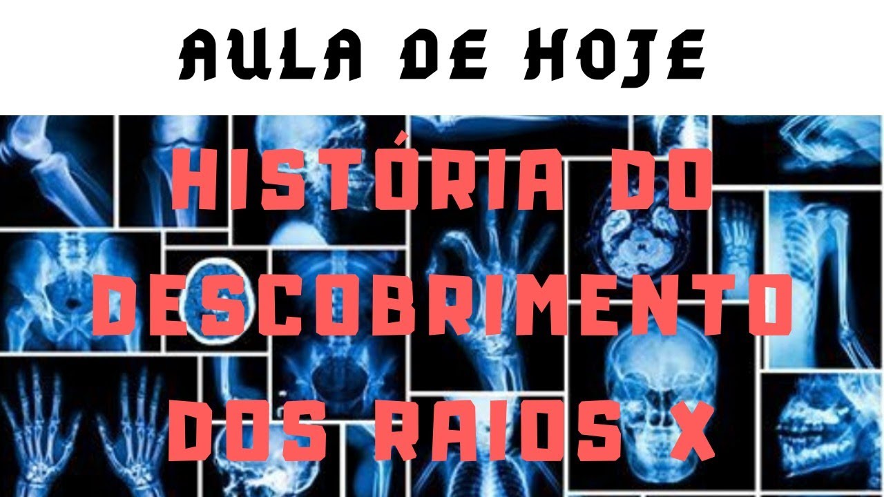 HISTÓRIA BÁSICA DA DESCOBERTA DOS RAIOS X
