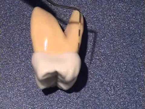 Maxillary First Molar: The Keystone of the Upper Jaw | Vibepedia