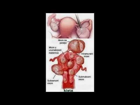 Bagaimana meningkatkan forum penis Impotensi pria yang membuat wanita
