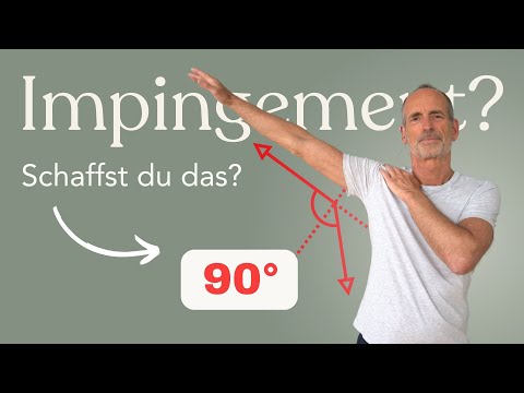 Impingement Syndrom  Vermeide DAS! Schulter