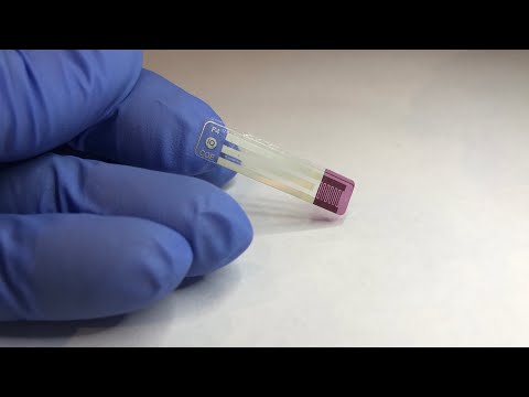 El sensor que acaba con los pinchazos para los diabéticos: mide el azúcar con la saliva