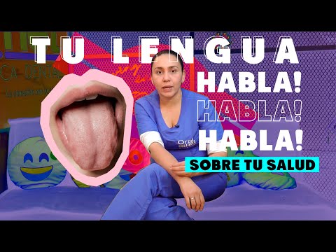 What is your tongue saying about your health? | Oralnet