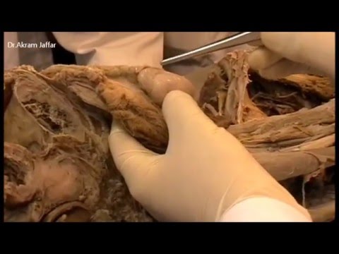 Dissection du Testicule