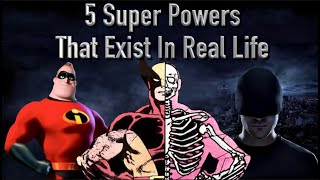 5 Super Powers People Have In Real Life
