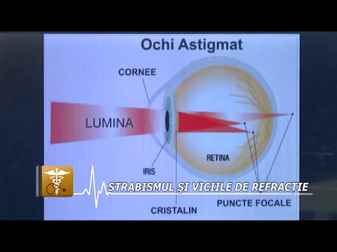 Atlas oftalmologie