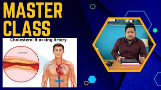 Download lagu How High cholesterol leads to heart attack ? Lipid profile test | Medical lecture in kokborok mp3 Download lagu How High cholesterol leads to heart attack ? Lipid profile test | Medical lecture in kokborok mp3