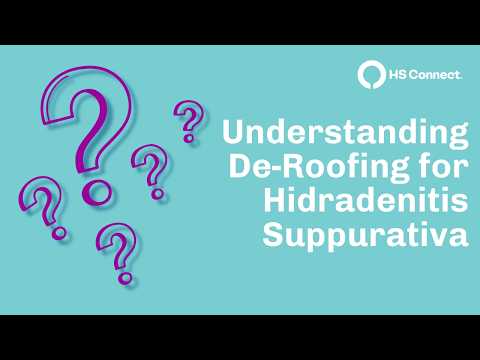 Understanding deroofing educational video