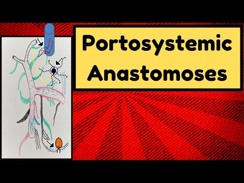 Portosystemic Anastomoses
