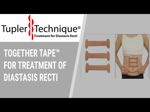 Together Tape™ for Treatment of Diastasis Recti Julie Tupler, RN 1