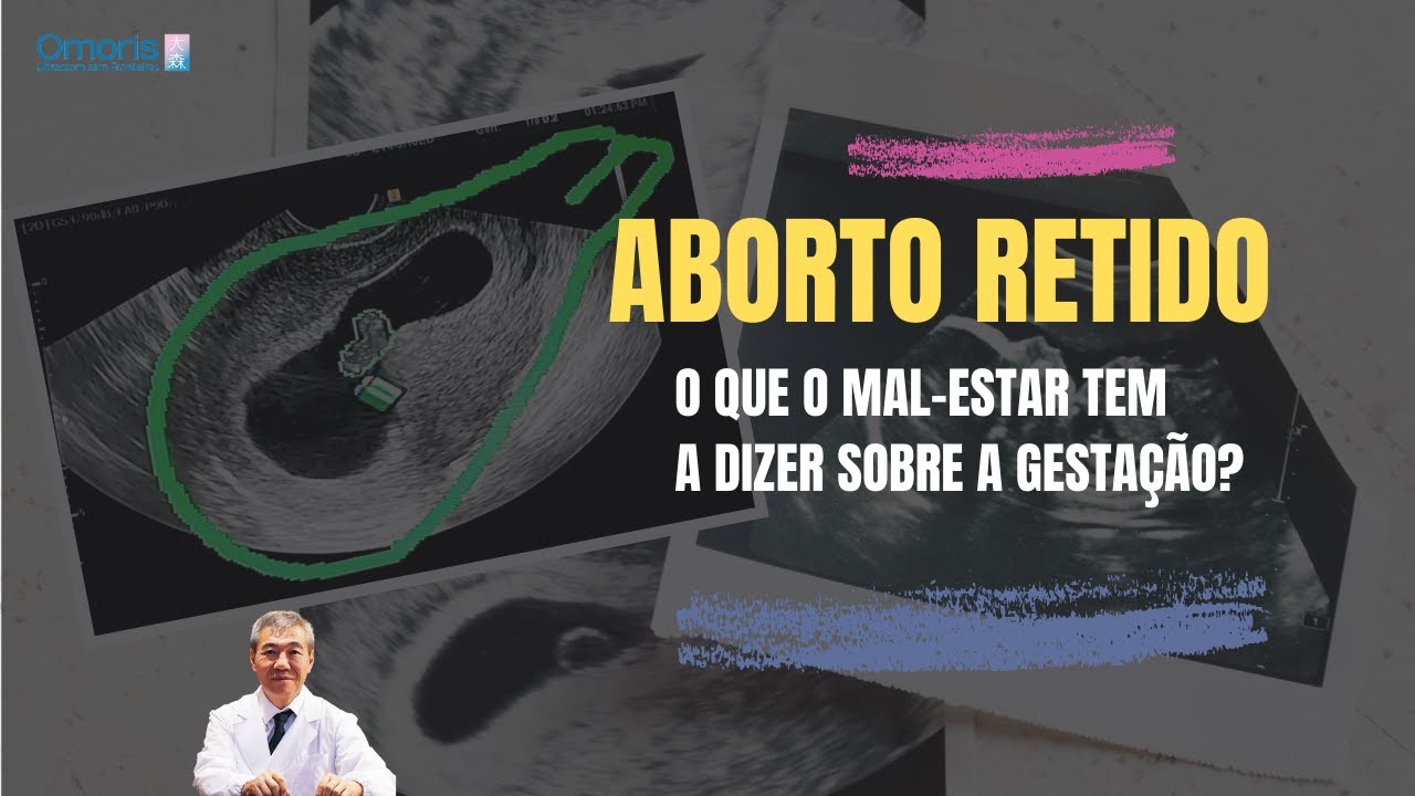 Missed abortion - What does discomfort have to say about pregnancy?