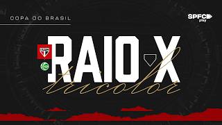 RAIO-X TRICOLOR: SÃO PAULO X JUVENTUDE | COPA DO BRASIL 2026