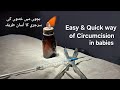 Circumcision Quick And Safe Method Dr Tayyab Riaz Ch