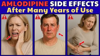 Amlodipine Side Effects After 5 Years: What Really Happens