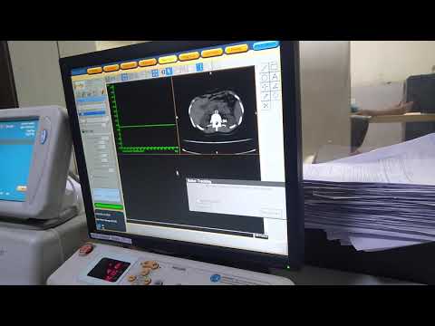 Refurbished Philips Ct Scan Machine