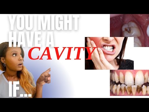 Signs and Symptoms of a Dental Cavity. 😩What  you MAY see or feel
