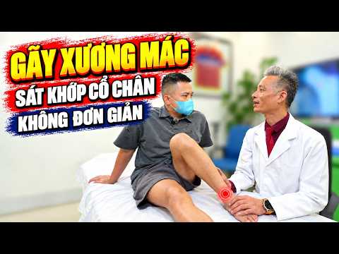 Gãy Xương Mác Sát Khớp Cổ Chân, Tháo Bột Vẫn Còn Phiền