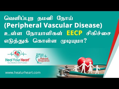 வெளிப்புற தமனி நோய் உள்ள நோயாளிகளால் இந்த வாசோ மெடிடெக் EECP சிகிச்சையை எடுத்துக்கொள்ள முடியுமா?