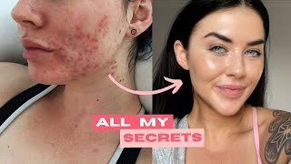 11 Glowing Skin Hacks: Get the BEST Skin of Your Life
