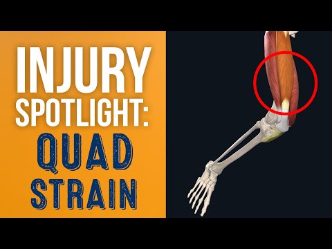 What is a Quad Strain?