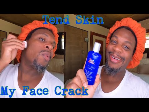 Tend Skin aka My FACE CRACK!!| Preventing Razor Bumps...