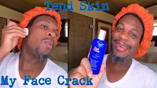 Tend Skin aka My FACE CRACK!!| Preventing Razor Bumps and Ingrown Hairs