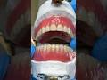 Try In Dentures Lsk121shorts Teeth Dental